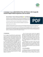 Case Report Treatment of An Adult Skeletal Class III Patient With Surgically Assisted Rapid Palatal Expansion and Facemask