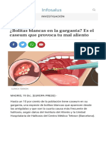 Noticia Bolitas Blancas Garganta Caseum Provoca Mal Aliento 20171219154424.html