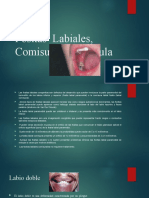 Fositas Labiales, Comisurales y Fistula