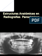 Estructuras Anatómicas en RX Panorámicas