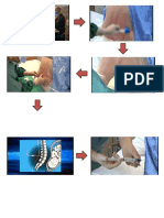 Drug Study - Epidural Anesthesia