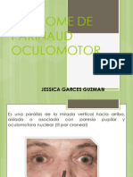 Sindrome de Parinaud Oculomotor