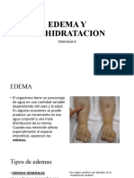 Edema Deshidratación