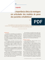 Qual A Importância Clínica Da Montagem em Articulador Dos Modelos de Gesso Dos Pacientes Ortodônticos