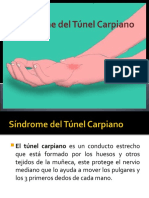 Síndrome Del Túnel Carpiano