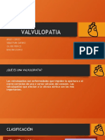 VALVULOPATIA