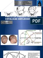 Parto en Presentaciones Cefalicas Deflexionadas GETSEMANI