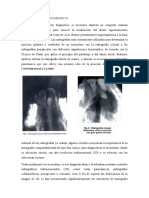 Diagnostico Radiografico en El Papel de La Cirugia Bucal