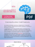 Tomografia en Neurologia y Neurocirugia