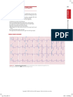 Atlas de Electrocardiografia