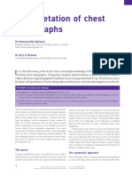 Interpretation of Chest Radiograph