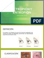 Ectropión y Entropión