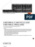 Benign Vulvar Lesion: Sources: Comprehensive Gynecology