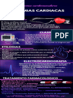 ARRITMIAS iNFOGRAFIA