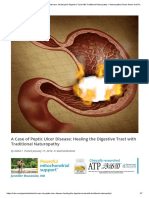 Peptic Ulcer 2