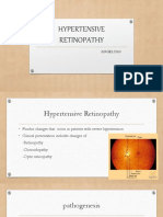 Hypertensive Retinopathy