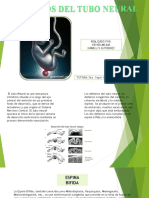 Defectos Del Tubo Neural