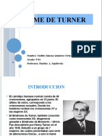 Sindrome de Turner