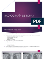 RX de Torax 2