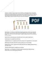 .Introduction Fracture