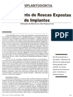 Recobrimento de Roscas Expostas de Implantes