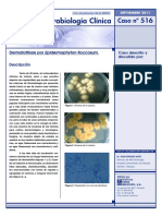 Caso Clinico Dermatofitosis