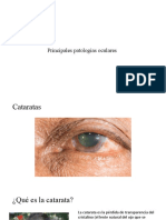 Patologías Oculares