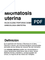 Miomatosis y Leiomiosarcoma Uterino