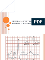 02 - ECG - General Approach and Normal Aspects 2