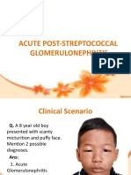 Acute Post-Streptococcal Glomerulonephritis