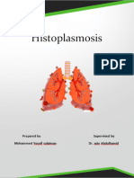 Histoplasmosis