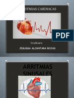 Arritmias Cardiacas