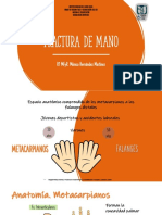 Fractura de Mano