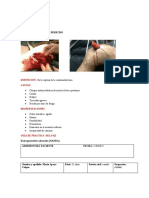 Fractura de Femur PAE