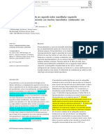 Taurodontismo Endo - En.es