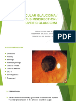 Neo Vascular Glaucoma (NVG) PPT GAURAV