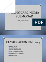 Adenocarcinoma Pulmonar