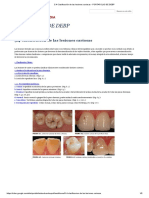 5.4 Clasificación de Las Lesiones Cariosas - PORTAFOLIO DE DEBP