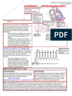 Orthdromic Vs Antidromic SVT, and Why It Matters