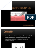 Colgajo Periodontal