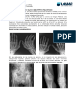 Caso Clínico de Artritis Reumatoide