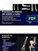 FracturaDiafisisAntebrazo TyO 1