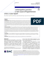 Acute Bilateral Ureteropelvic Junction Obstruction As A Rare Cause of Hypertensive Crisis: A Case Report