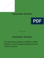 Caesareansection 100515015852 Phpapp02