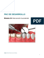 Tratamiento de Tartrectomía y Tinciones