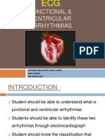 Ecg Junctionalventriculararrhythmias 140109180429 Phpapp02