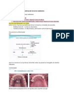 Protesis Parcial Removible