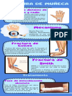 Fractura de Muñeca