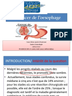 9 - Cancer de L Oesophage