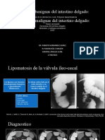 Neoplasias Del Intestino Delgado